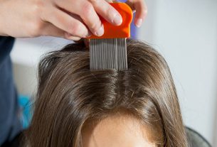 Tips on how to get rid of head lice